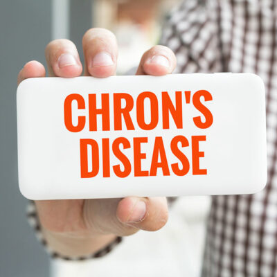 All You Need to Know about Chron’s disease